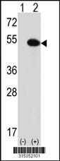 Western blot analysis of his-tag TEKT1 (arrow) using his tag antibody. 293 cell lysates (2 ug/lane) either nontransfected (Lane 2) or transiently transfected with theTEKT1 gene