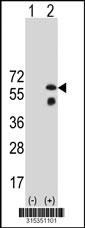 Western blot analysis of his-tag DTNBP1 (arrow) using his tag antibody. 293 cell lysates (2 ug/lane) either nontransfected (Lane 2) or transiently transfected with theDTNBP1 gene