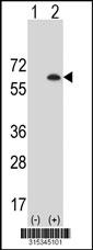 Western blot analysis of his-tag TCHP (arrow) using his tag antibody. 293 cell lysates (2 ug/lane) either nontransfected (Lane 2) or transiently transfected with theTCHP gene