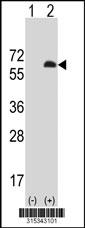 Western blot analysis of his-tag PLD3 (arrow) using his tag antibody. 293 cell lysates (2 ug/lane) either nontransfected (Lane 2) or transiently transfected with thePLD3 gene