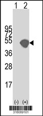 Western blot analysis of his-tag RNASEH2A (arrow) using his tag antibody. 293T cell lysates (2 ug/lane) either nontransfected (Lane 1) or transiently transfected with the RNASEH2A gene‘