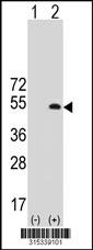 Western blot analysis of his-tag CD2BP2 (arrow) using his tag antibody. 293 cell lysates (2 ug/lane) either nontransfected (Lane 2) or transiently transfected with theCD2BP2 gene