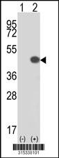 Western blot analysis of his-tag PSG5 (arrow) using his tag antibody. 293 cell lysates (2 ug/lane) either nontransfected (Lane 2) or transiently transfected with thePSG5 gene
