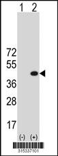Western blot analysis of his-tag SRGAP3 (arrow) using his tag antibody. 293 cell lysates (2 ug/lane) either nontransfected (Lane 2) or transiently transfected with theSRGAP3 gene