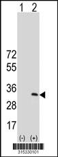 Western blot analysis of his-tag LRRC18 (arrow) using his tag antibody. 293 cell lysates (2 ug/lane) either nontransfected (Lane 2) or transiently transfected with theLRRC18 gene