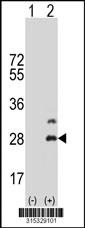 Western blot analysis of his-tag CD300LB (arrow) using his tag antibody. 293 cell lysates (2 ug/lane) either nontransfected (Lane 2) or transiently transfected with theCD300LB gene