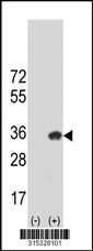 Western blot analysis of his-tag TPD52L2 (arrow) using his tag antibody. 293 cell lysates (2 ug/lane) either nontransfected (Lane 2) or transiently transfected with theTPD52L2 gene
