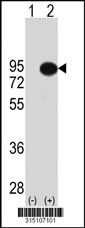 Western blot analysis of his-tag RALBP1 (arrow) using his tag antibody. 293T cell lysates (2 ug/lane) either nontransfected (Lane 1) or transiently transfected with the RALBP1 gene‘