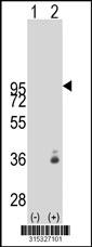 Western blot analysis of his-tag REEP2 (arrow) using his tag antibody. 293 cell lysates (2 ug/lane) either nontransfected (Lane 2) or transiently transfected with theREEP2 gene