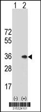 Western blot analysis of his-tag PSMD9 (arrow) using his tag antibody. 293 cell lysates (2 ug/lane) either nontransfected (Lane 2) or transiently transfected with thePSMD9 gene