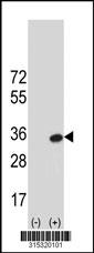 Western blot analysis of his-tag RALB (arrow) using his tag antibody. 293 cell lysates (2 ug/lane) either nontransfected (Lane 2) or transiently transfected with theRALB gene