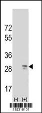 Western blot analysis of his-tag SRGN (arrow) using his tag antibody. 293 cell lysates (2 ug/lane) either nontransfected (Lane 2) or transiently transfected with theSRGN gene