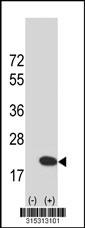 Western blot analysis of his-tag LSM4 (arrow) using his tag antibody. 293 cell lysates (2 ug/lane) either nontransfected (Lane 2) or transiently transfected with theLSM4 gene