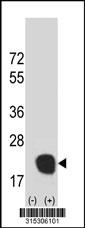 Western blot analysis of his-tag CALML5 (arrow) using his tag antibody. 293 cell lysates (2 ug/lane) either nontransfected (Lane 2) or transiently transfected with theCALML5 gene
