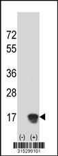 Western blot analysis of his-tag TM6SF1 (arrow) using his tag antibody. 293 cell lysates (2 ug/lane) either nontransfected (Lane 2) or transiently transfected with theTM6SF1 gene