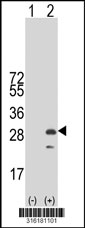 Western blot analysis of his-tag RIT1 (arrow) using his tag antibody. 293T cell lysates (2 ug/lane) either nontransfected (Lane 1) or transiently transfected with the RIT1 gene‘