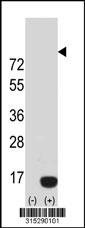 Western blot analysis of his-tag DYNLRB1 (arrow) using his tag antibody. 293 cell lysates (2 ug/lane) either nontransfected (Lane 2) or transiently transfected with theDYNLRB1 gene