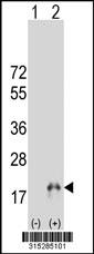 Western blot analysis of his-tag DEXI (arrow) using his tag antibody. 293 cell lysates (2 ug/lane) either nontransfected (Lane 2) or transiently transfected with theDEXI gene