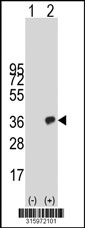 Western blot analysis of his-tag RGS18 (arrow) using his tag antibody. 293T cell lysates (2 ug/lane) either nontransfected (Lane 1) or transiently transfected with the RGS18 gene‘
