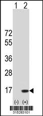 Western blot analysis of his-tag MYCBP (arrow) using his tag antibody. 293 cell lysates (2 ug/lane) either nontransfected (Lane 2) or transiently transfected with theMYCBP gene
