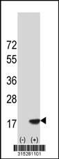 Western blot analysis of his-tag CCDC56 (arrow) using his tag antibody. 293 cell lysates (2 ug/lane) either nontransfected (Lane 2) or transiently transfected with theCCDC56 gene
