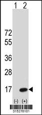 Western blot analysis of his-tag MIF (arrow) using his tag antibody. 293 cell lysates (2 ug/lane) either nontransfected (Lane 2) or transiently transfected with theMIF gene