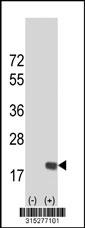 Western blot analysis of his-tag PFDN1 (arrow) using his tag antibody. 293 cell lysates (2 ug/lane) either nontransfected (Lane 2) or transiently transfected with thePFDN1 gene