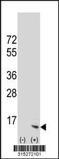 Western blot analysis of his-tag HIG2 (arrow) using his tag antibody. 293 cell lysates (2 ug/lane) either nontransfected (Lane 2) or transiently transfected with theHIG2 gene