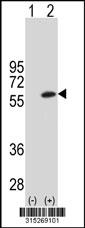 Western blot analysis of his-tag ATL1 (arrow) using his tag antibody. 293 cell lysates (2 ug/lane) either nontransfected (Lane 2) or transiently transfected with theATL1 gene