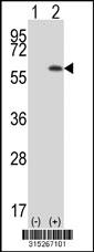 Western blot analysis of his-tag RAP1GDS1 (arrow) using his tag antibody. 293 cell lysates (2 ug/lane) either nontransfected (Lane 2) or transiently transfected with theRAP1GDS1 gene