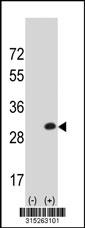 Western blot analysis of his-tag RPL15 (arrow) using his tag antibody. 293 cell lysates (2 ug/lane) either nontransfected (Lane 2) or transiently transfected with theRPL15 gene