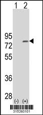 Western blot analysis of his-tag KIAA0859 (arrow) using his tag antibody. 293 cell lysates (2 ug/lane) either nontransfected (Lane 2) or transiently transfected with theKIAA0859 gene