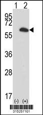 Western blot analysis of his-tag PAPOLB (arrow) using his tag antibody. 293 cell lysates (2 ug/lane) either nontransfected (Lane 2) or transiently transfected with thePAPOLB gene
