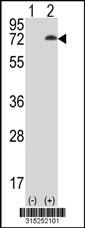 Western blot analysis of his-tag POT1 (arrow) using his tag antibody. 293 cell lysates (2 ug/lane) either nontransfected (Lane 2) or transiently transfected with thePOT1 gene