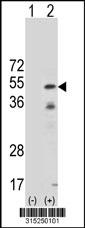 Western blot analysis of his-tag NT5C2 (arrow) using his tag antibody. 293 cell lysates (2 ug/lane) either nontransfected (Lane 2) or transiently transfected with theNT5C2 gene