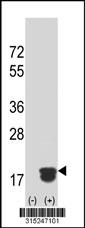 Western blot analysis of his-tag RER1 (arrow) using his tag antibody. 293 cell lysates (2 ug/lane) either nontransfected (Lane 2) or transiently transfected with theRER1 gene