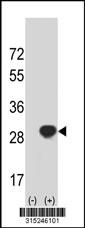 Western blot analysis of his-tag NUDT16L1 (arrow) using his tag antibody. 293 cell lysates (2 ug/lane) either nontransfected (Lane 2) or transiently transfected with theNUDT16L1 gene
