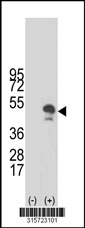 Western blot analysis of his-tag RBMY1A1 (arrow) using his tag antibody. 293T cell lysates (2 ug/lane) either nontransfected (Lane 1) or transiently transfected with the RBMY1A1 gene‘