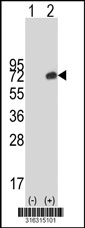 Western blot analysis of his-tag ZNF394 (arrow) using his tag antibody. 293T cell lysates (2 ug/lane) either nontransfected (Lane 1) or transiently transfected with the ZNF394 gene‘