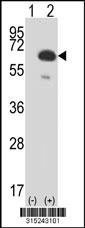Western blot analysis of his-tag NXF1 (arrow) using his tag antibody. 293 cell lysates (2 ug/lane) either nontransfected (Lane 2) or transiently transfected with theNXF1 gene
