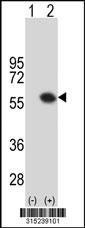 Western blot analysis of his-tag OXCT1 (arrow) using his tag antibody. 293 cell lysates (2 ug/lane) either nontransfected (Lane 2) or transiently transfected with theOXCT1 gene