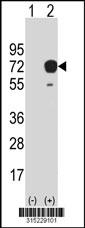 Western blot analysis of his-tag UTP3 (arrow) using his tag antibody. 293 cell lysates (2 ug/lane) either nontransfected (Lane 2) or transiently transfected with theUTP3 gene