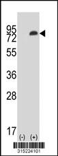 Western blot analysis of his-tag OLFM1 (arrow) using his tag antibody. 293 cell lysates (2 ug/lane) either nontransfected (Lane 2) or transiently transfected with theOLFM1 gene