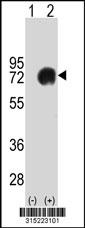 Western blot analysis of his-tag IL21R (arrow) using his tag antibody. 293 cell lysates (2 ug/lane) either nontransfected (Lane 2) or transiently transfected with theIL21R gene