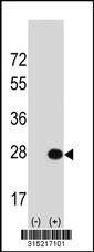 Western blot analysis of his-tag CAPSL (arrow) using his tag antibody. 293 cell lysates (2 ug/lane) either nontransfected (Lane 2) or transiently transfected with theCAPSL gene