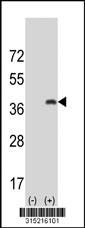 Western blot analysis of his-tag PPP1R2 (arrow) using his tag antibody. 293 cell lysates (2 ug/lane) either nontransfected (Lane 2) or transiently transfected with thePPP1R2 gene