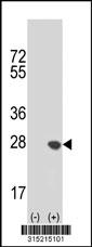 Western blot analysis of his-tag NOL6 (arrow) using his tag antibody. 293 cell lysates (2 ug/lane) either nontransfected (Lane 2) or transiently transfected with theNOL6 gene