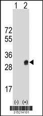 Western blot analysis of his-tag MSC (arrow) using his tag antibody. 293 cell lysates (2 ug/lane) either nontransfected (Lane 2) or transiently transfected with theMSC gene