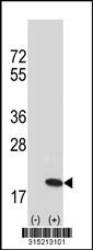 Western blot analysis of his-tag C16orf80 (arrow) using his tag antibody. 293 cell lysates (2 ug/lane) either nontransfected (Lane 2) or transiently transfected with theC16orf80 gene