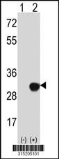 Western blot analysis of his-tag NKIRAS2 (arrow) using his tag antibody. 293 cell lysates (2 ug/lane) either nontransfected (Lane 2) or transiently transfected with theNKIRAS2 gene
